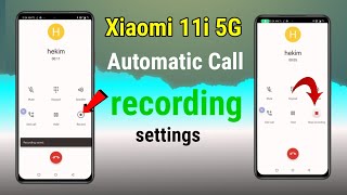 Xiaomi 11i 5G automatic call recording settings [upl. by Anirres805]