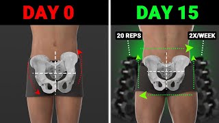 The Best Weight Training Exercises To Fix Lateral Pelvic Tilt asymmetrical hips [upl. by Eneiluj]