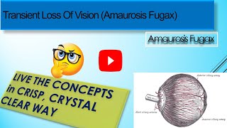 Transient Loss Of Vision Amaurosis Fugax [upl. by Ayatnohs116]