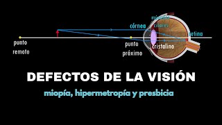 Defectos de la visión miopía hipermetropía y presbicia Óptica Bachillerato Ejercicios resueltos [upl. by Budde]