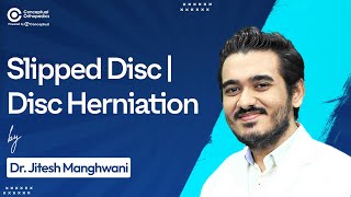 Slipped Disc and Disc Herniation By Dr Jitesh Manghwani  Conceptual Orthopedics [upl. by Ibson]