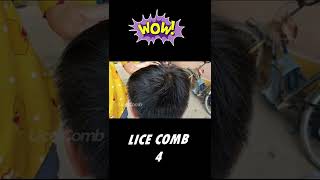 Removal Big Lice Part4 licecomb short [upl. by Arev]