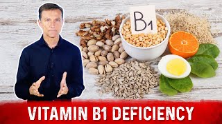 Top Signs and Symptoms of Vitamin B1 Deficiency – Dr Berg [upl. by Allemrac162]