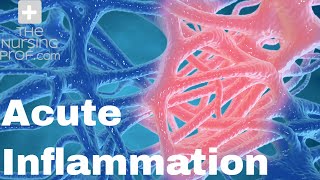 Acute Inflammation The First Line of Defense [upl. by Hazelton]