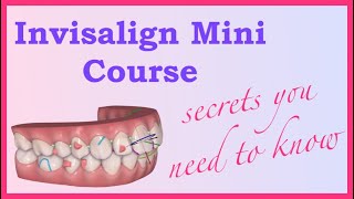 The Basics  Invisalign Mini Course 1 of 8 [upl. by Oned]