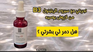 تجربتىمع سيروم الريتينول من لاروش بوزيه La Roche Posay Retinol Serum b3 [upl. by Zolly]