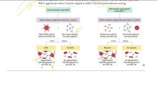 6 Coombs testing  Direct and Indirect Coombs Test  USMLE STEP 1 [upl. by Airrotal761]