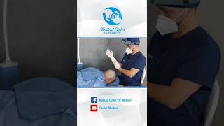 👨‍🦲 TRASPLANTE CAPILAR ✅ En 1 minuto 👨‍⚕ [upl. by Delores]