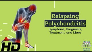 Relapsing Polychondritis Demystified From Symptoms to Solutions [upl. by Hajin]