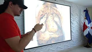 ESTUDIOS TOMOGRAFIA  ABDOMEN PELVIS COLUMNA Y EXTREMIDADES  LIVE DESDE EL AULA ☢️ 📹 [upl. by Bornie]