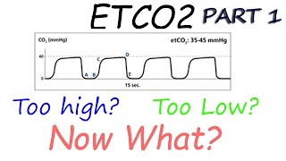 Capnography Waveform Interpretation Etco2 basics explained [upl. by Nnylyoj]