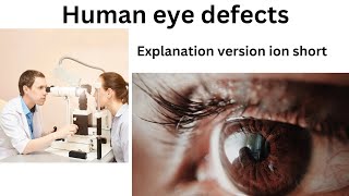 human eye defects explanation short version studylabtop biology study [upl. by Nepets]