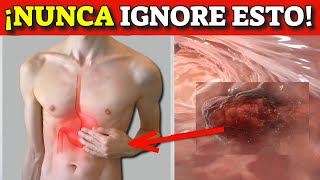 ¡CÁNCER de ESTÓMAGO SÍGNOS y SÍNTOMAS de ALERTA que NUNCA DEBES IGNORAR [upl. by Matusow976]