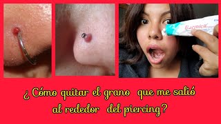 ¿Cómo quitar granobultoqueloide que me salió al rededor del piercing [upl. by Beatrix]