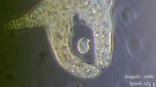 Amoeba eats paramecia  Amoebas lunch   Amoeba Endocytosis  Phagocytosis Part 1  👌 [upl. by Hammel]