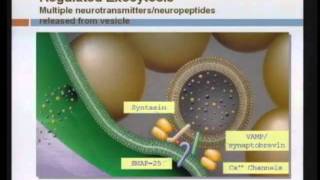 Spasticity Management [upl. by Franza]