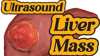 Liver Mass Ultrasound  Hepatic Parenchymal Disease  Ascites  Spleen [upl. by Iclek]