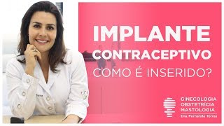 IMPLANON  Como é colocado o Implante Anticoncepcional [upl. by Concordia722]