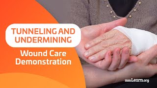 Tunneling and Undermining  Wound Care Demonstration [upl. by Autumn]