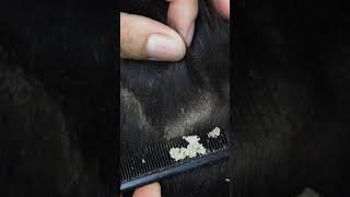 Satisfying Combing and Scratching Dry Scalp shorts dandruff [upl. by Ocirema868]