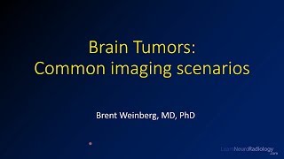 Imaging brain tumors  6  Common imaging scenarios [upl. by Emarej]