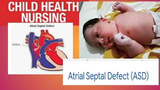 Atrial Septal Defect  Child Health Nursing 2nd class 2 with notes Congenital Heart disease [upl. by Gurney]