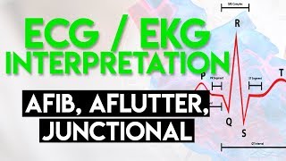 Afib Aflutter Junctional Arrhythmias  ECG EKG Interpretation Part 4 [upl. by Barthold]