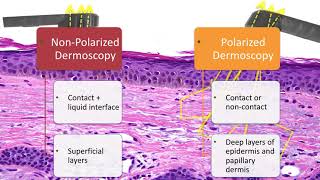 Principles of Dermoscopy  Dr Natalia Jaimes [upl. by Bjork]