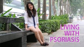 Living With Psoriasis  CNA Insider [upl. by Riggins]