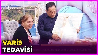 Varis Tedavisi Nasıl Olur  Dr Feridun Kunak Show  27 Mart 2019 [upl. by Tiffy]