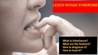 Lesch Nyhan Syndrome  Features Diagnosis Treatment Inheritance [upl. by Cimah]