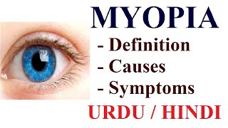 What is Myopia Near or Short sightedness  Causes Symptoms Treatment  Urdu  Hindi [upl. by Ettedanreb]