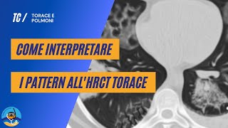 Come interpretare i pattern allHRCT torace  parte 1 [upl. by Intihw145]