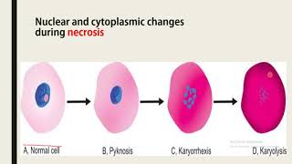 pyknosiskaryorrhexiskaryolysis يُنتَفع به [upl. by Gavin]