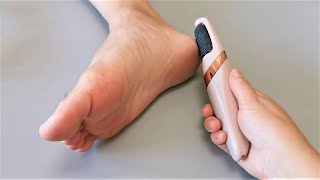 Electric Foot Callus Remover Unboxing and Review  Scam or Legit [upl. by Ahseikan]