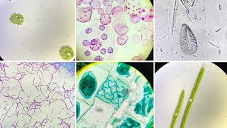 Microscopic Slides of Algae Live and Prepared [upl. by Ainaznat791]