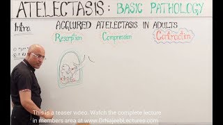 Atelectasis  Resorption Compression and Contraction [upl. by Nnaylime506]