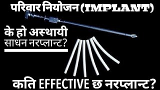 के हो अस्थायी साधन नरप्लान्टफाइदा र बेफाइदा केके छनFamily planning Methods norplant  implant [upl. by Anelet]