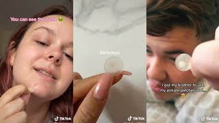 TRYING PIMPLE PATCH TIKTOK COMPILATION [upl. by Nairoc]