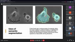 3 UNet and UNet for Medical Image Segmentation  Abhirath Anand [upl. by Edyak196]