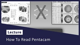 How To Read Pentacam [upl. by Latsyek863]