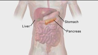 Pancreatic cancer symptoms Day 7 [upl. by Erhard]