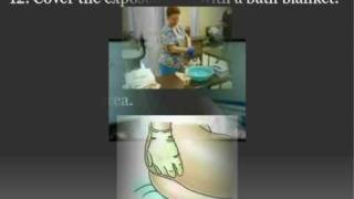 CNA Skill  Providing Perineal Care for Female Patient [upl. by Cyn]