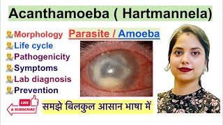 Acanthamoeba Hartmannela Parasite in Hindi  Life Cycle  Lab Diagnosis  Parasitology [upl. by Zipah]