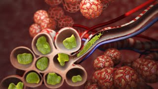 Pneumonia  Discharge Instructions  Nucleus Health [upl. by Barna]