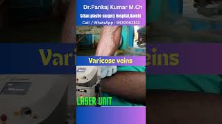 Laser treatment of varicose veins varicose veins surgery shorts varicoseveins [upl. by Oisorbma]