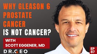 Why Gleason 6 Prostate Cancer is Not Cancer with Dr Scott Eggener EP 87 [upl. by Sergo]