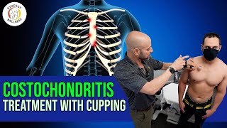 Costochondritis Treatment with Cupping [upl. by Lempres]