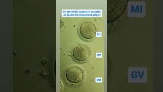 Human oocytes by maturity immature MI germinal vesicle GV mature MII Яйцеклітини людини [upl. by Annauqaj]