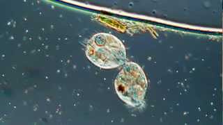 Lamour Or Cell Division in the Ciliated Protozoa Oxytricha 500X [upl. by Essenaj]